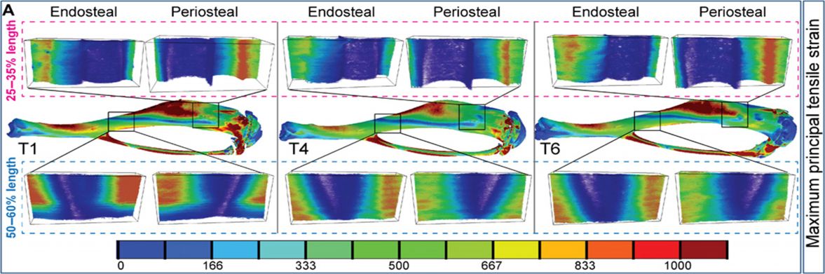 Maximum principal tensile strain on the loaded tibia