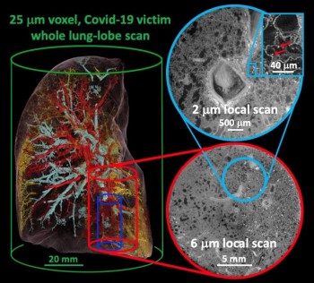 Hierarchical Phase-Contrast Tomography (HiP-CT)